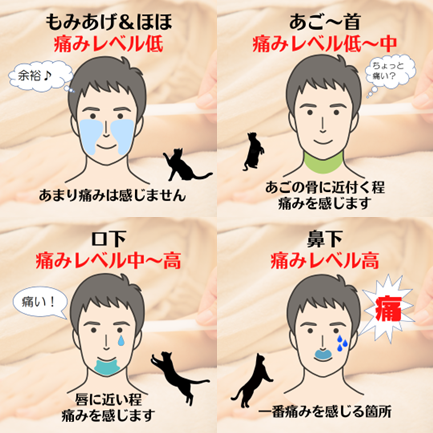 ヒゲ脱毛痛みレベル
